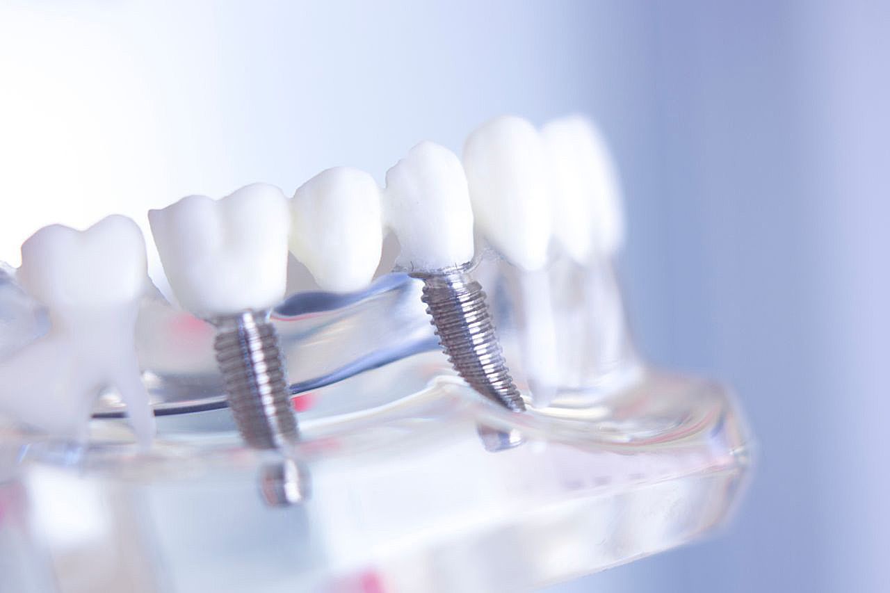 implantologia katowice