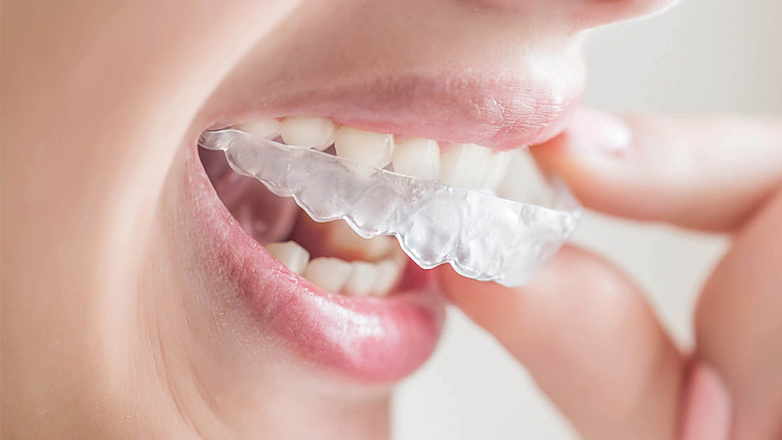 invisalign katowice