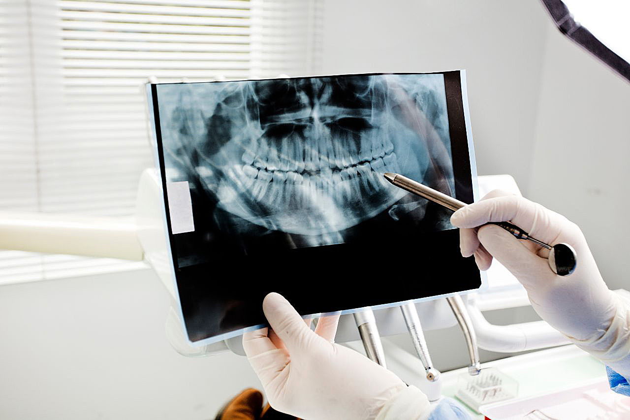 rtg zębów katowice